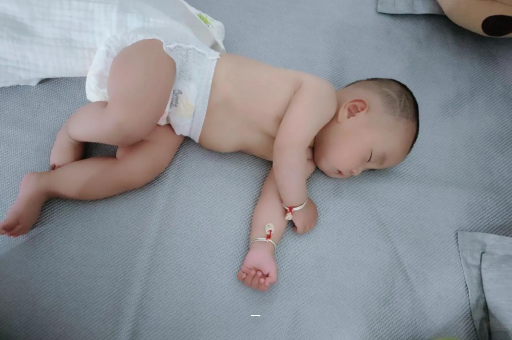 黔东南宝宝脸上有白色斑块